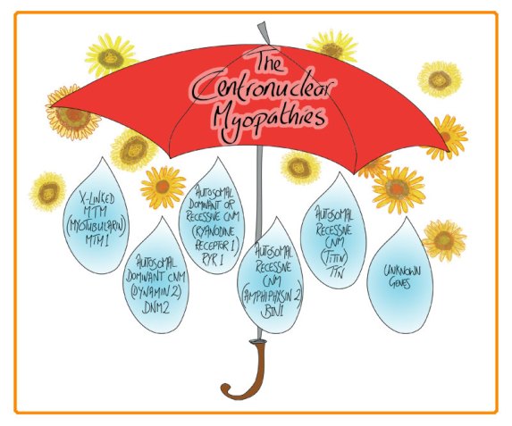 Umbrella image illustrating different forms of centronuclear myopathies.